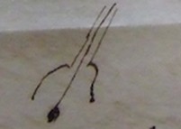 cupping device